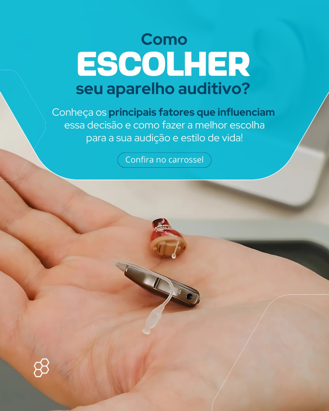 Como escolher seu aparelho auditivo?